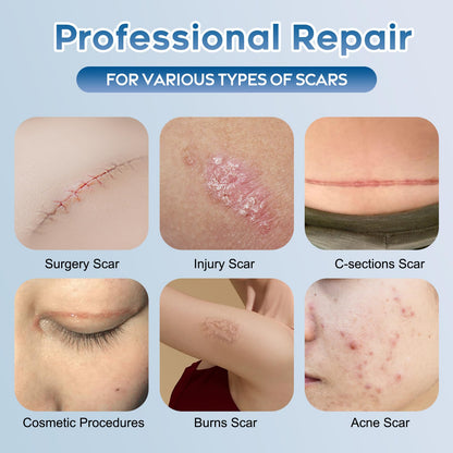 Glowor Advanced Silicone Scar Gel for Face & Body – Scar Cream for Old & New Scars
