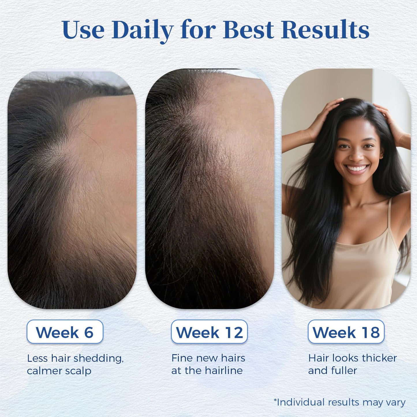 Gluvelessia Hair Growth Serum Roll-On with Rosemary – Thicker, Fuller Hair for Men & Women