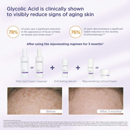Glytone Mild Cream Cleanser | Gentle 3.4% Free-Acid Glycolic Exfoliation & Hydration | 2 oz
