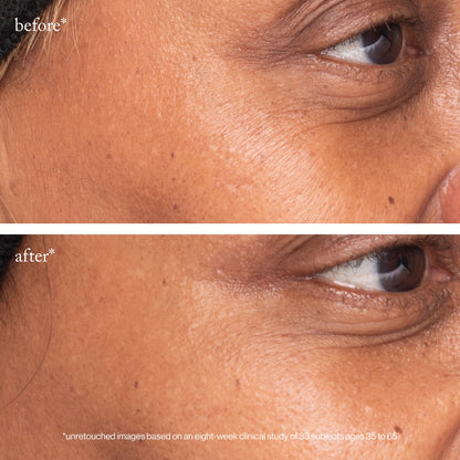 Goop Beauty 3x Retinol Eye Lift Serum – Fine Lines & Wrinkles Treatment | 0.5 oz