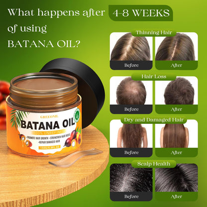 GREEONIL Batana Oil with Scalp Massager Brush for Hair Growth – 100% Pure & Organic