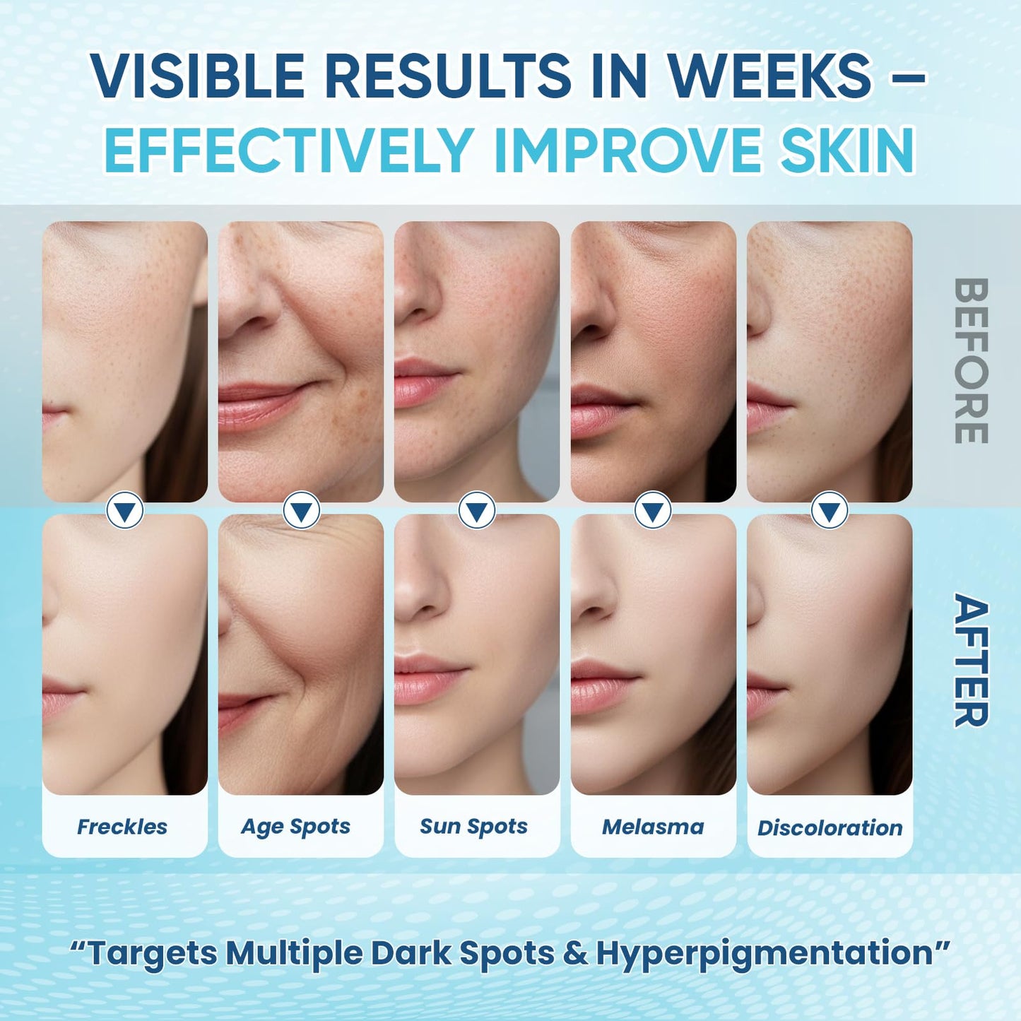 Greoay Dark Spot Remover Serum for Face & Body – Hyperpigmentation Treatment, Brighten & Even Skin Tone, 2 x 1 Fl Oz