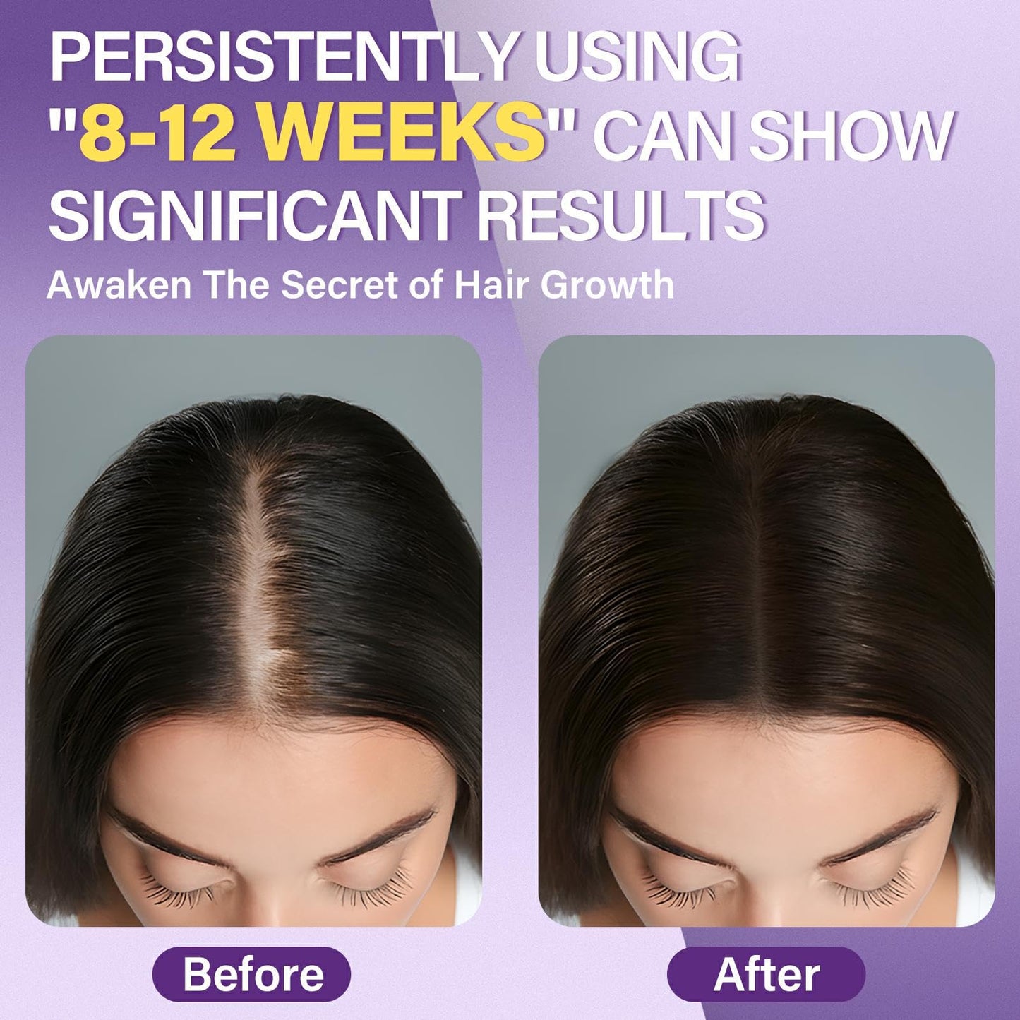 Greoay 5% Minoxidil Foam for Women – Hair Growth for Thinning Hair, Receding Hairline, 3 Bottles (2.11 oz Each)