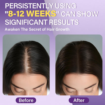 Greoay 5% Minoxidil Foam for Women – Hair Growth for Thinning Hair, Receding Hairline, 3 Bottles (2.11 oz Each)