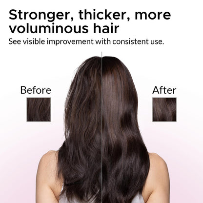 Growth Essence Minoxidil Shampoo for Women – 2% Regrowth Formula with Biotin, Caffeine & DHT Blockers