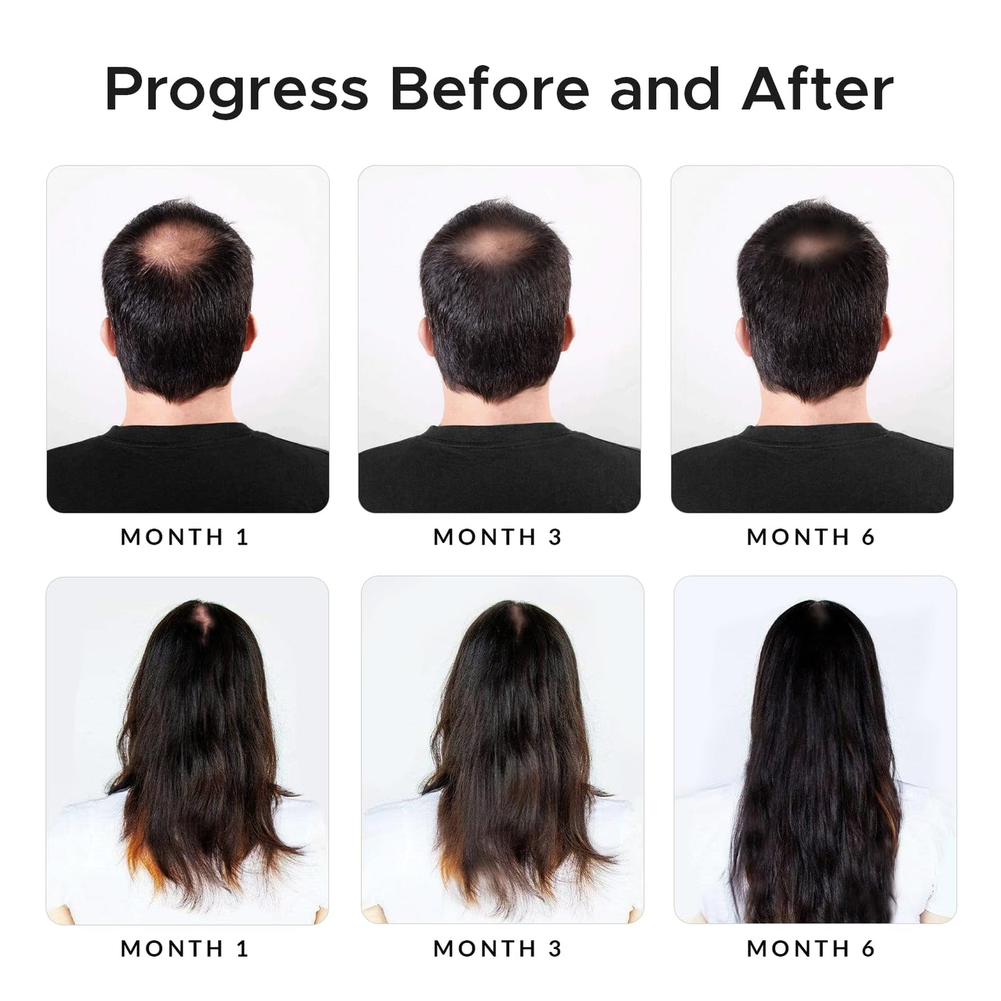 Growth Essence Twopack Thickening Hair Regrowth Shampoo – Minoxidil & Biotin