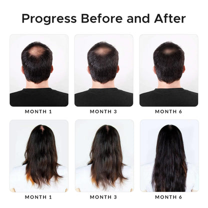 Growth Essence Twopack Thickening Hair Regrowth Shampoo – Minoxidil & Biotin