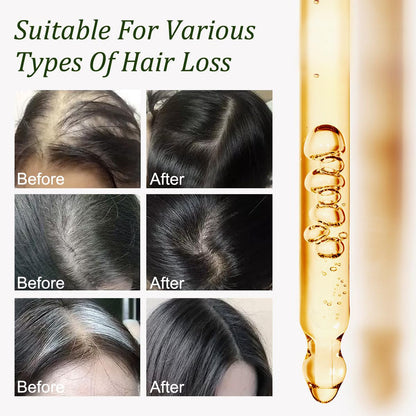 Gypsophila Batana Oil for Hair Growth – 100% Pure, Scalp Nourishment, Breakage Reduction (1 Fl Oz)