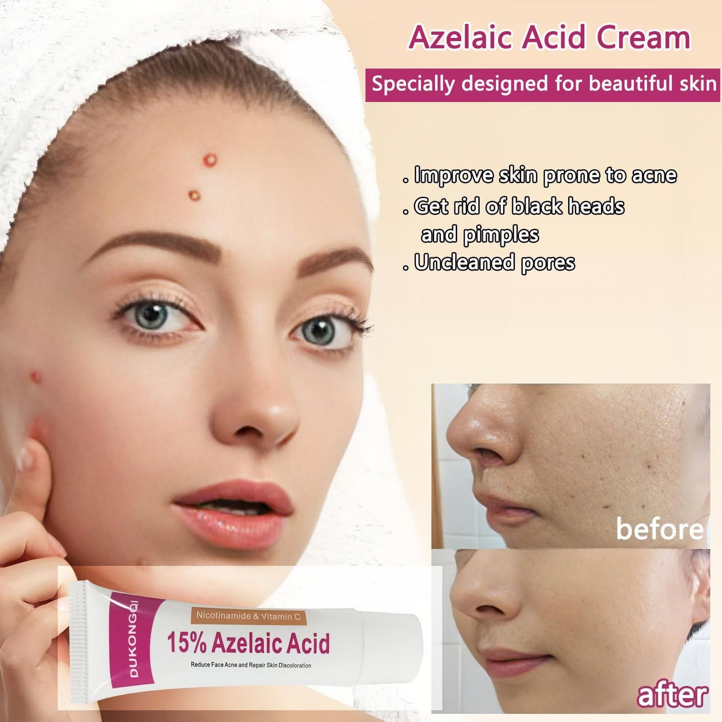 gzchaox Azelaic Acid Cream – 15% Facial Care Essence, 20g for Acne and Redness