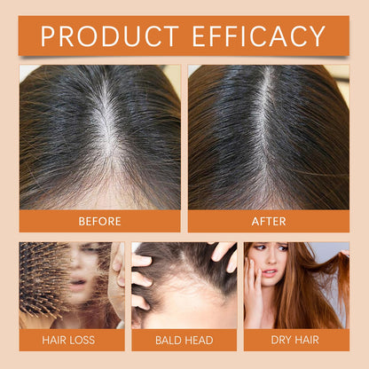 Hair Growth Ampoules with Turmeric Root Extract – Plant-Based Scalp Treatment for Thicker Hair (Fragrance-Free, 7pcs)