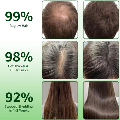 Hair Regrowth System | Advanced Biotin & Ginseng Serum for Thicker Hair