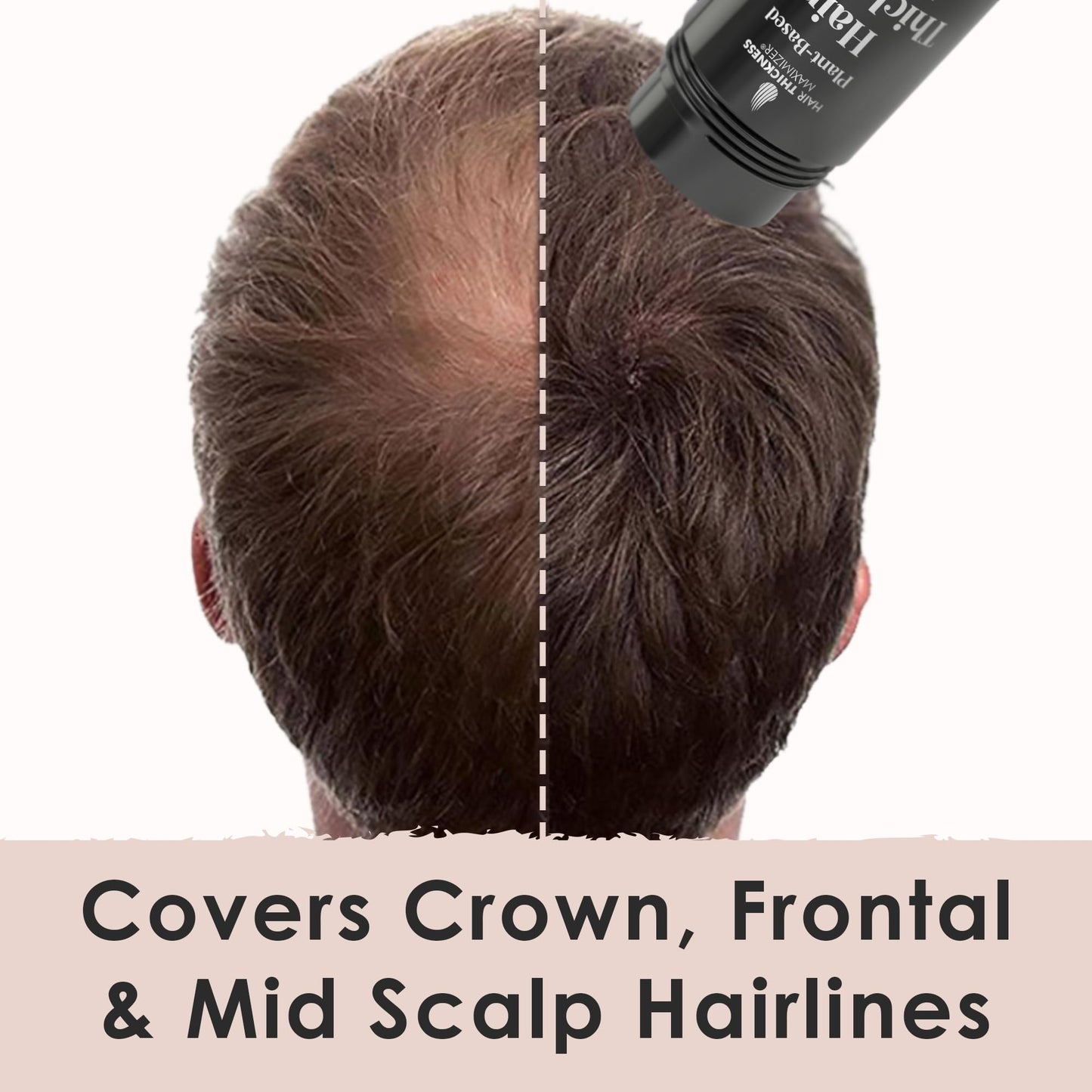 Hair Thickness Maximizer Hair Fibers for Thinning Hair — Plant-Based, Instant Coverage for Women & Men | Non-Itchy, Easy Washout (Medium Brown)