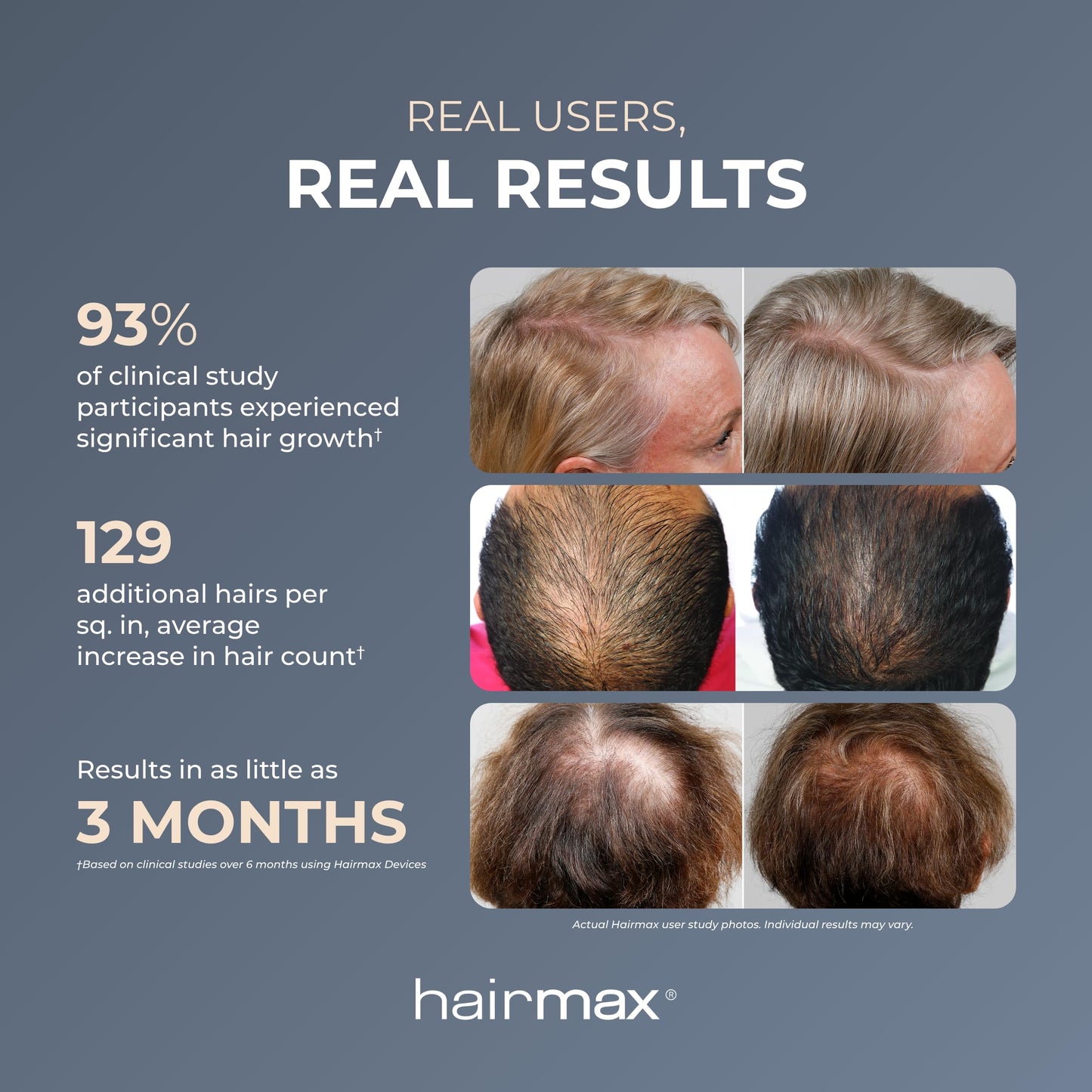HairMax PowerFlex 272 Laser Cap – FDA Cleared, 7-Minute Hair Growth Sessions