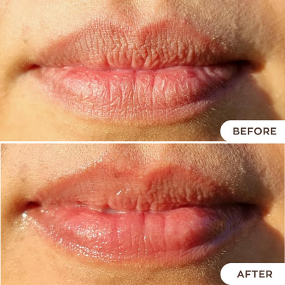 Hanalei Lip Treatment – Intensive Overnight Hydration with Kukui Oil, Shea Butter & Grapeseed Oil | Cruelty-Free 15g
