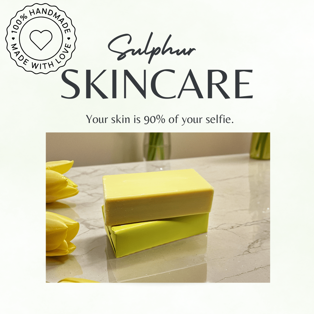 Maximum Strength 10% Sulphur Soap Bar | Handmade in Yorkshire, UK