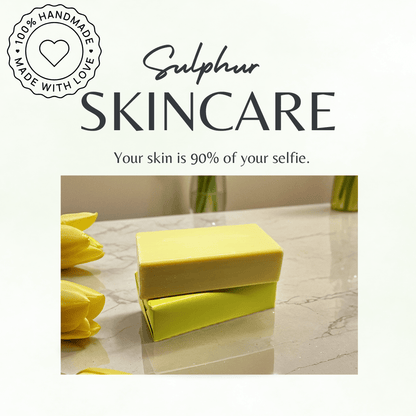 Maximum Strength 10% Sulphur Soap Bar | Handmade in Yorkshire, UK