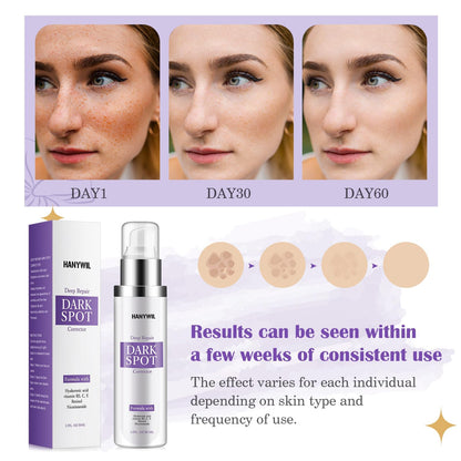 HANYWIL Dark Spot Serum with Retinol & Niacinamide – Even Tone, 1.7 fl oz