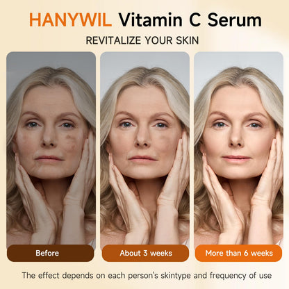 HANYWIL 20% Vitamin C Serum for Mature Skin — Target Age Spots & Wrinkles