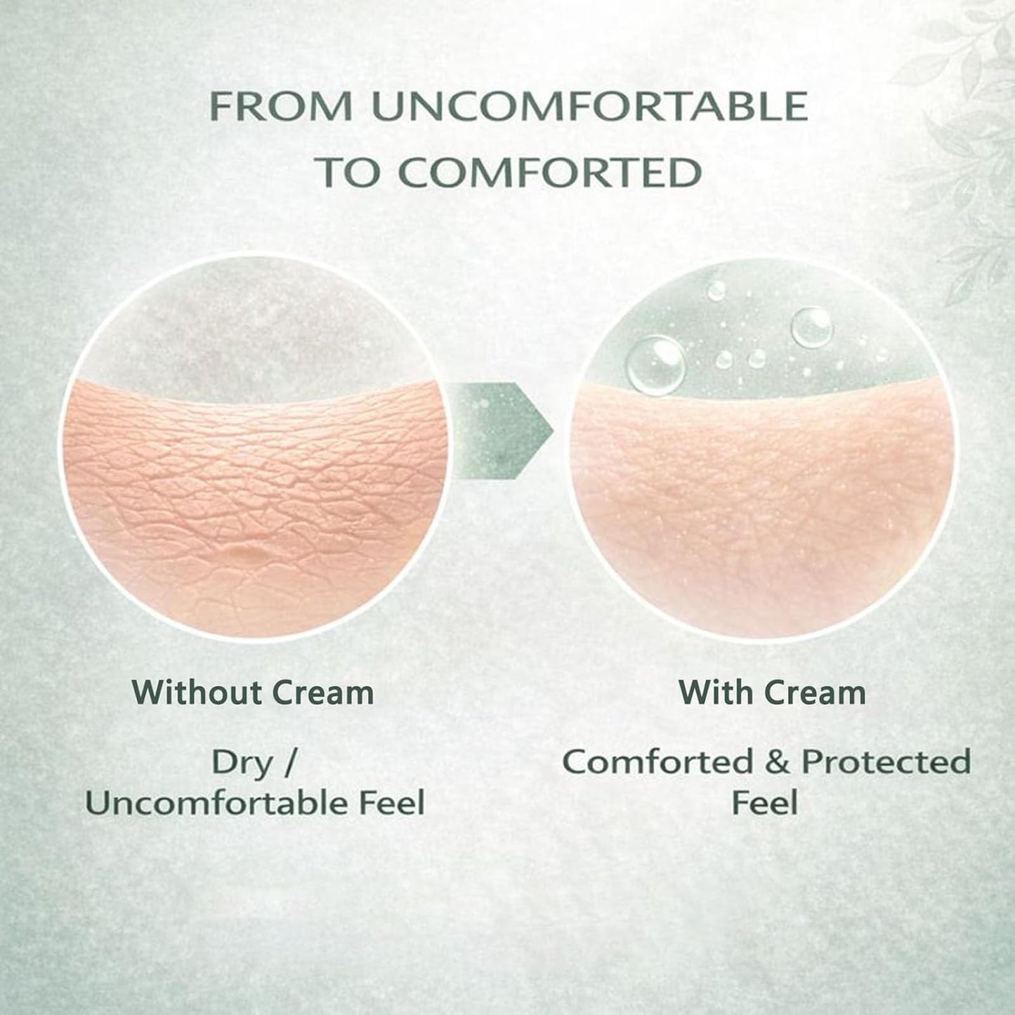 Hea Lora Intertrigo Cream – Skin Fold Care with Zinc Oxide & Undecylenic Acid | Non-Steroid (2PCS)