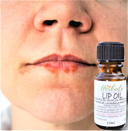 Herbal Lip Oil Lotion for Cold Sore Relief – Soothing Invisible Natural Lip Treatment
