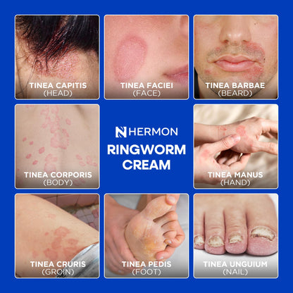 Hermon Antifungal Cleansing Soap – Ringworm Care (Tea Tree & Sulfur) 2-Pack