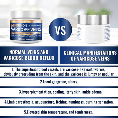 Hermon Varicose & Spider Veins Cream – Natural Circulation Support, Soothing Leg Care (3.4 oz)