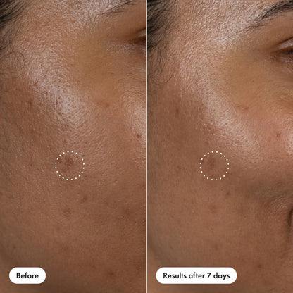 Hero Cosmetics Dark Spot Correct – 15% Vitamin C + Hyaluronic Acid Serum