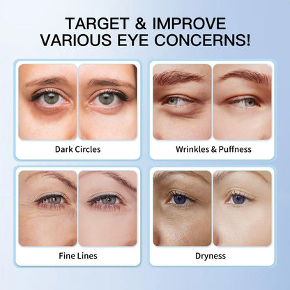 HGTG Eye Serum 5% Caffeine & 5% Retinol | Dark Circles, Puffiness, Fine Lines