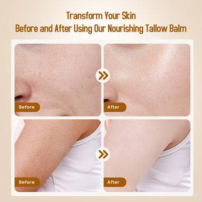 Hicream Beef Tallow Balm | 100% Organic Grass-Fed Moisturizer for Dry Skin