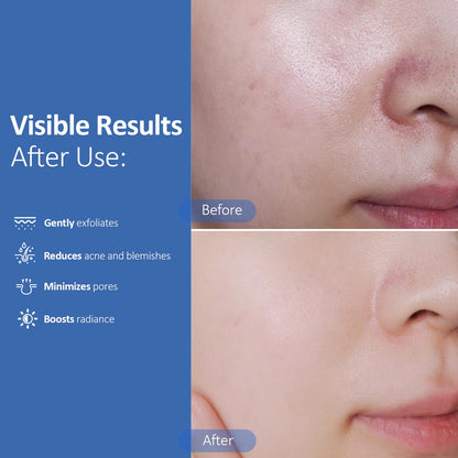 Hicream Glycolic Acid Exfoliating Pads | Dual-Texture Toner for Pore Care & Radiance
