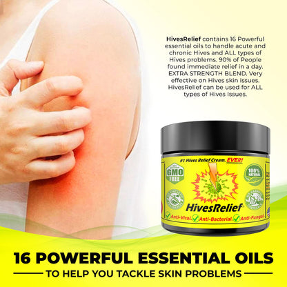HivesRelief Cream – Fast-Acting Natural Hives Relief