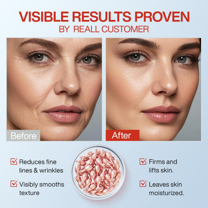 HKH Retinol Serum Capsules for Face – Anti-Aging Vitamin A & E (38 Caps), Travel-Friendly