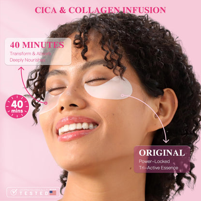 ICIKOL Under Eye Patches with Collagen – Deep Hydration Hydrogel Mask for Puffy Eyes & Dark Circles (30 Pairs)