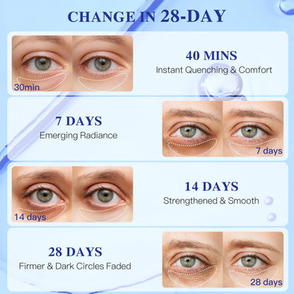 ICIKOL Under Eye Mask Blueberry – Collagen Patches (12 Pairs)