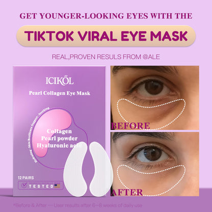 ICIKOL Collagen Under Eye Patches Mask – Deep Hydration & Puffiness Reduction (12 Pairs, Pearl Powder)