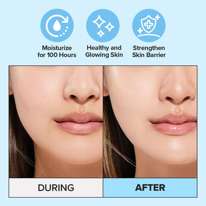 I DEW CARE Hydra Vibes 10-Hyaluronic Acid Serum with Jeju Hydrangea — Ultra Hydration (30ml)