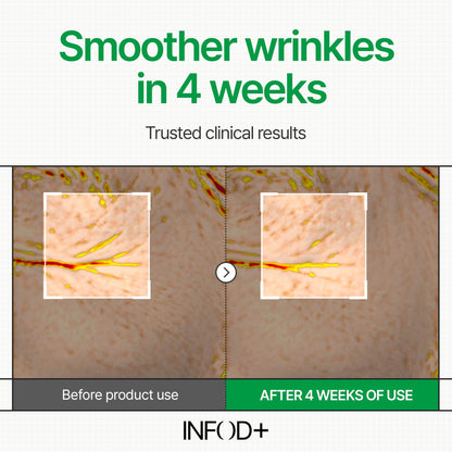 INFODPLUS Korean Skin Care Sensitive Face Cream – Lightweight Ceramides & Panthenol Moisturizer (50ml)