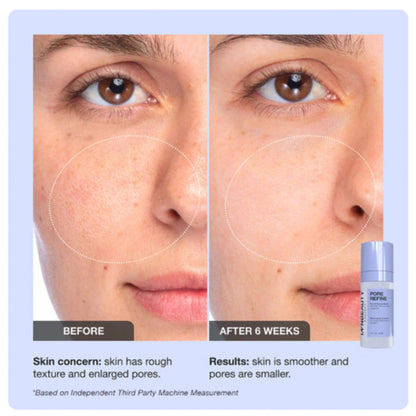 INNBEAUTY Project Pore Refine Serum – Pore Tightening & Texture Smoothing, 1 oz