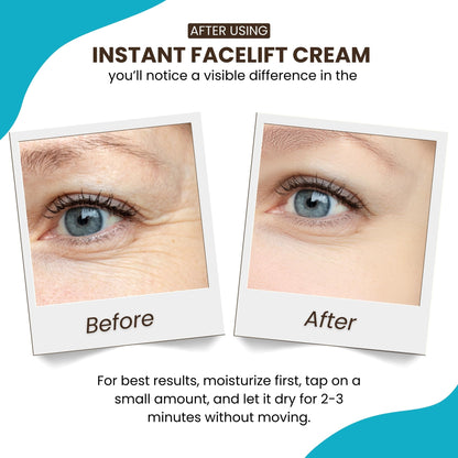Instantly Ageless - Instant Face Lift Cream for Puffy Eyes, Dark Circles & Wrinkles (15 Vials)