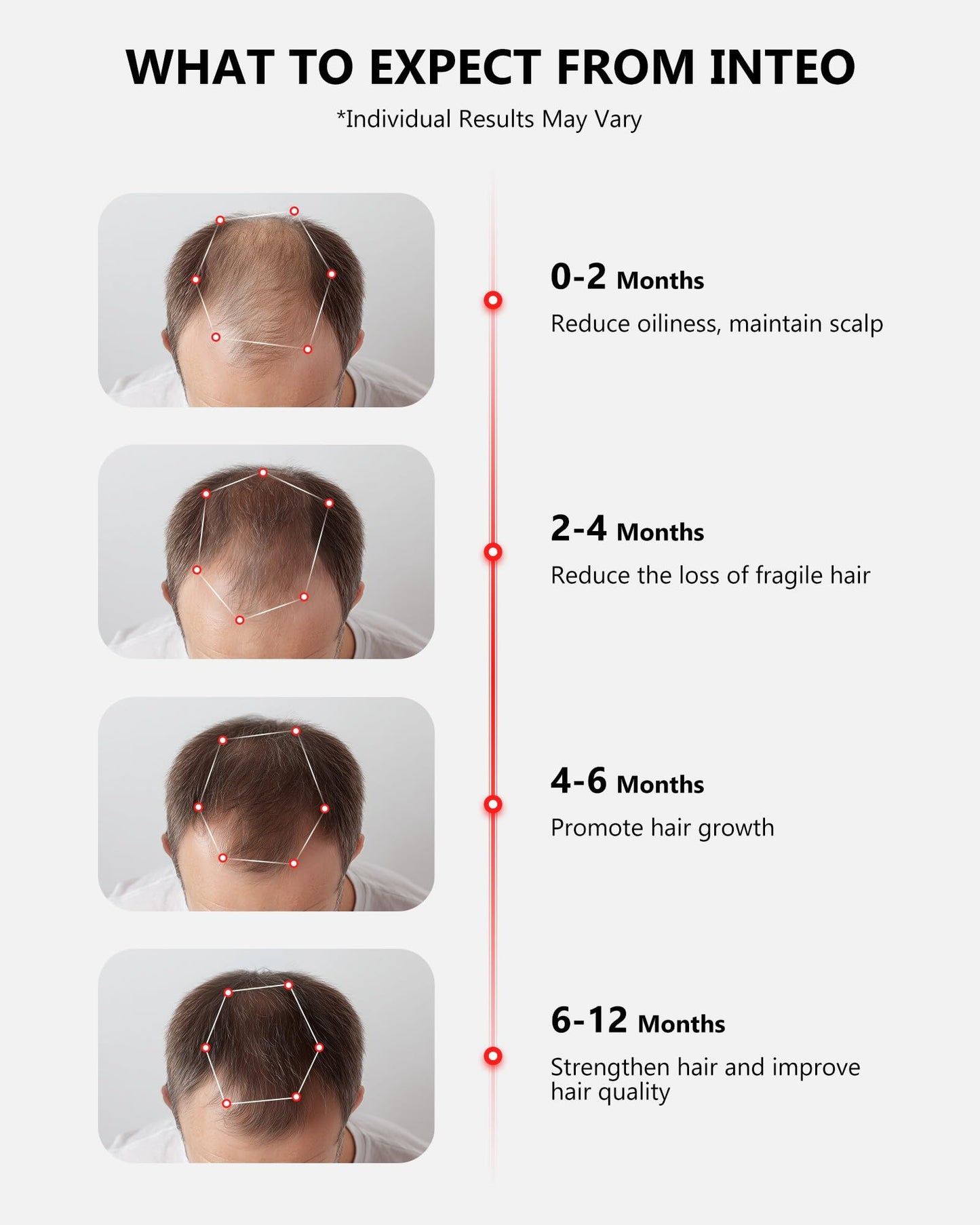 INTEO 162-Laser Red Light Hair Growth Cap – Wireless, FDA-Cleared Hair Growth Helmet for Men & Women