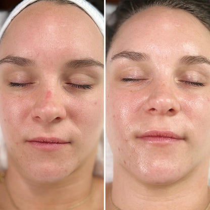 Intraceuticals Rejuvenate Daily Serum – Deep Hydration, Radiance & Makeup Prep