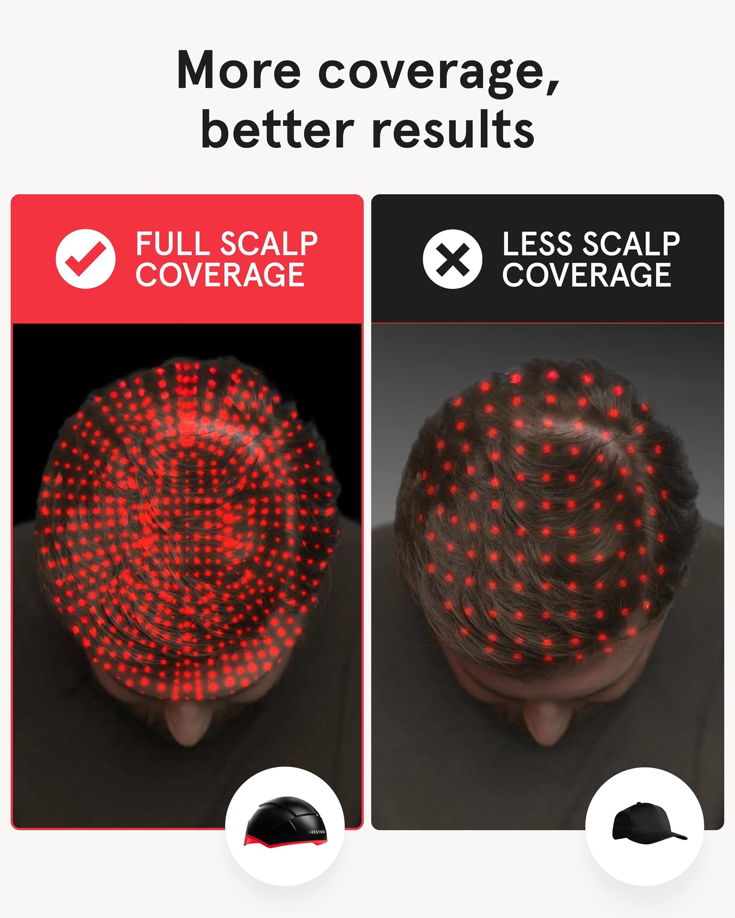 iRestore Elite + Rechargeable Battery Pack | Hair Growth Laser Cap (500 Lasers & LEDs) | FDA Cleared