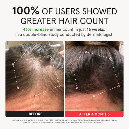 iRestore Elite + Rechargeable Battery Pack | Hair Growth Laser Cap (500 Lasers & LEDs) | FDA Cleared