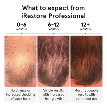 iRestore Pro + Rechargeable Battery Pack – 282 Lasers & LEDs Red Light Therapy for Hair Growth (FDA Cleared)