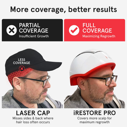 iRestore Pro: 282 Lasers & LEDs Hair Growth System | FDA Cleared
