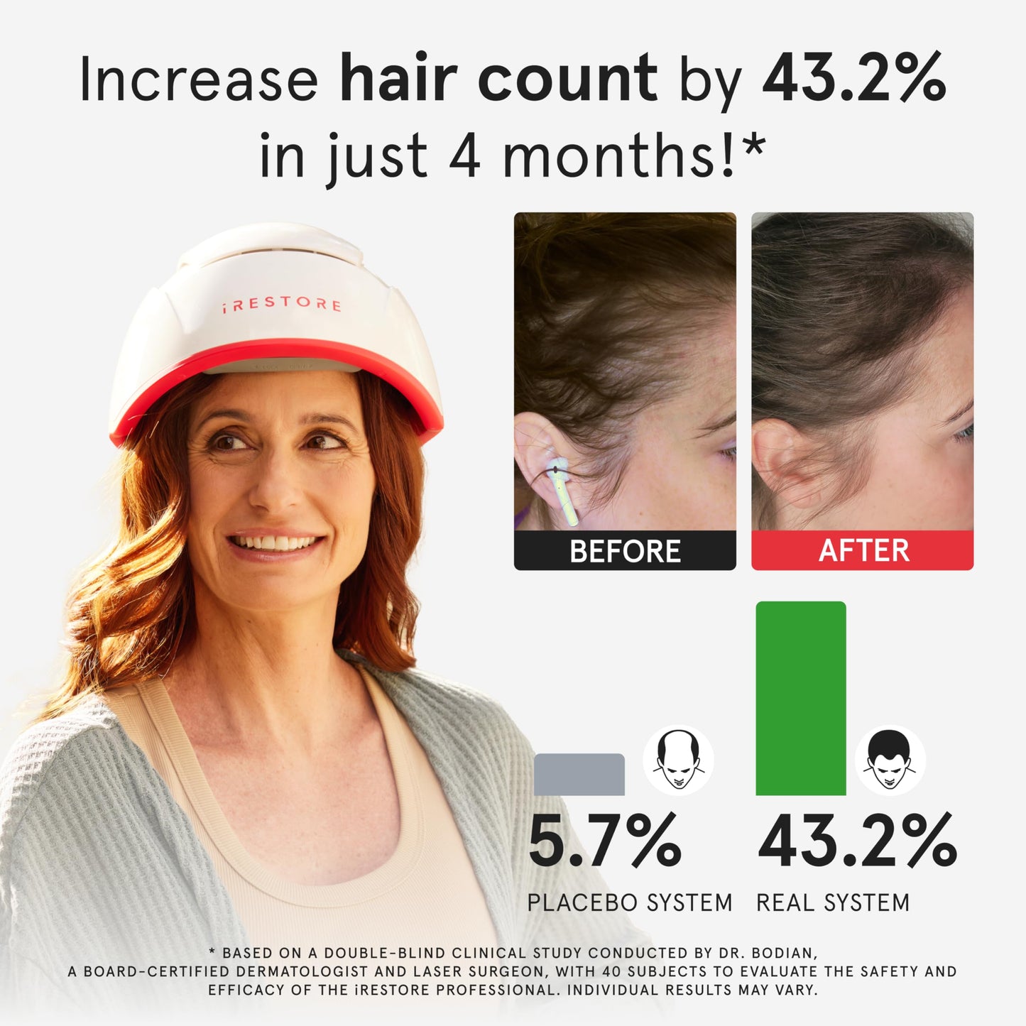 iRestore Pro: 282 Lasers & LEDs Hair Growth System | FDA Cleared