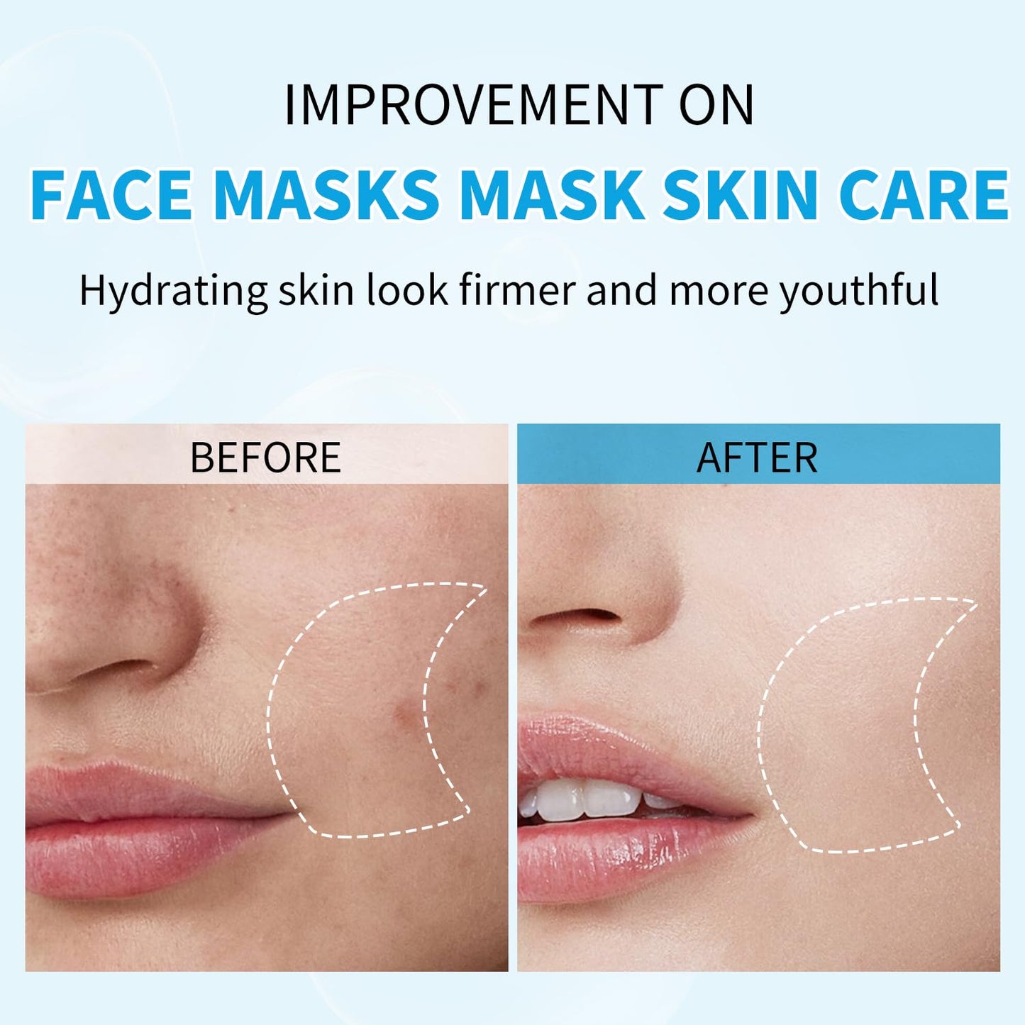 IREV Hyaluronic Acid Face Mask | Hydrating Sheet Mask for All Skin Types (Pack of 10)