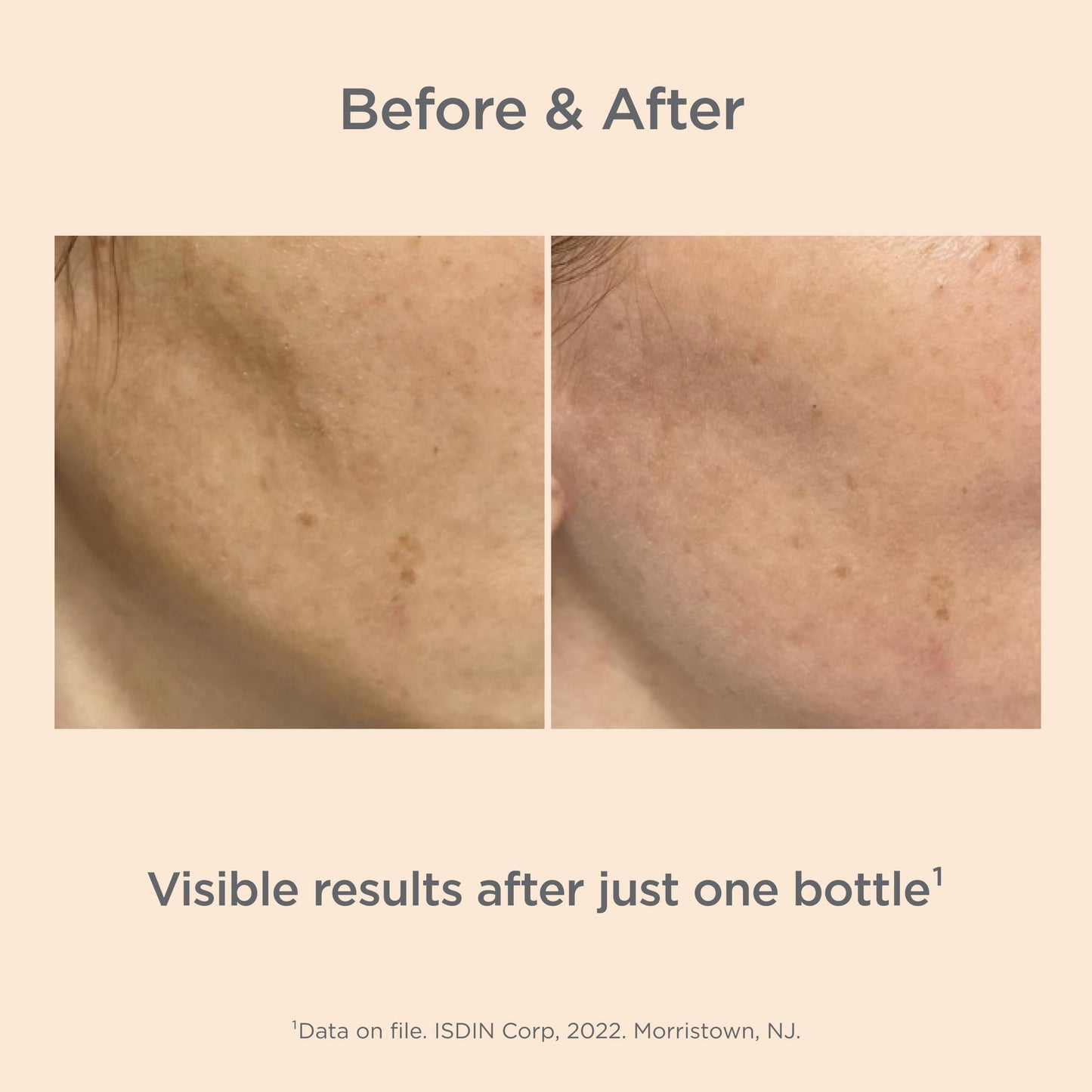 ISDIN Melaclear Advanced Dark Spot Corrector with Niacinamide – 1.7 fl oz