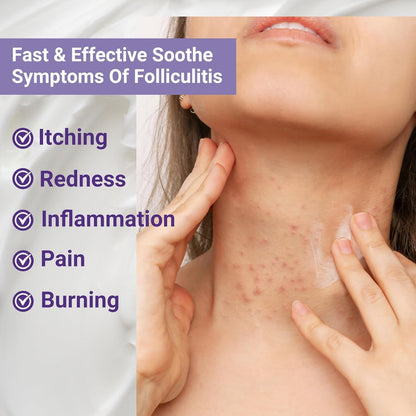 ishancare Folliculitis Treatment Cream – Natural Relief for Itching, Redness & Inflammation | 3.53 Oz