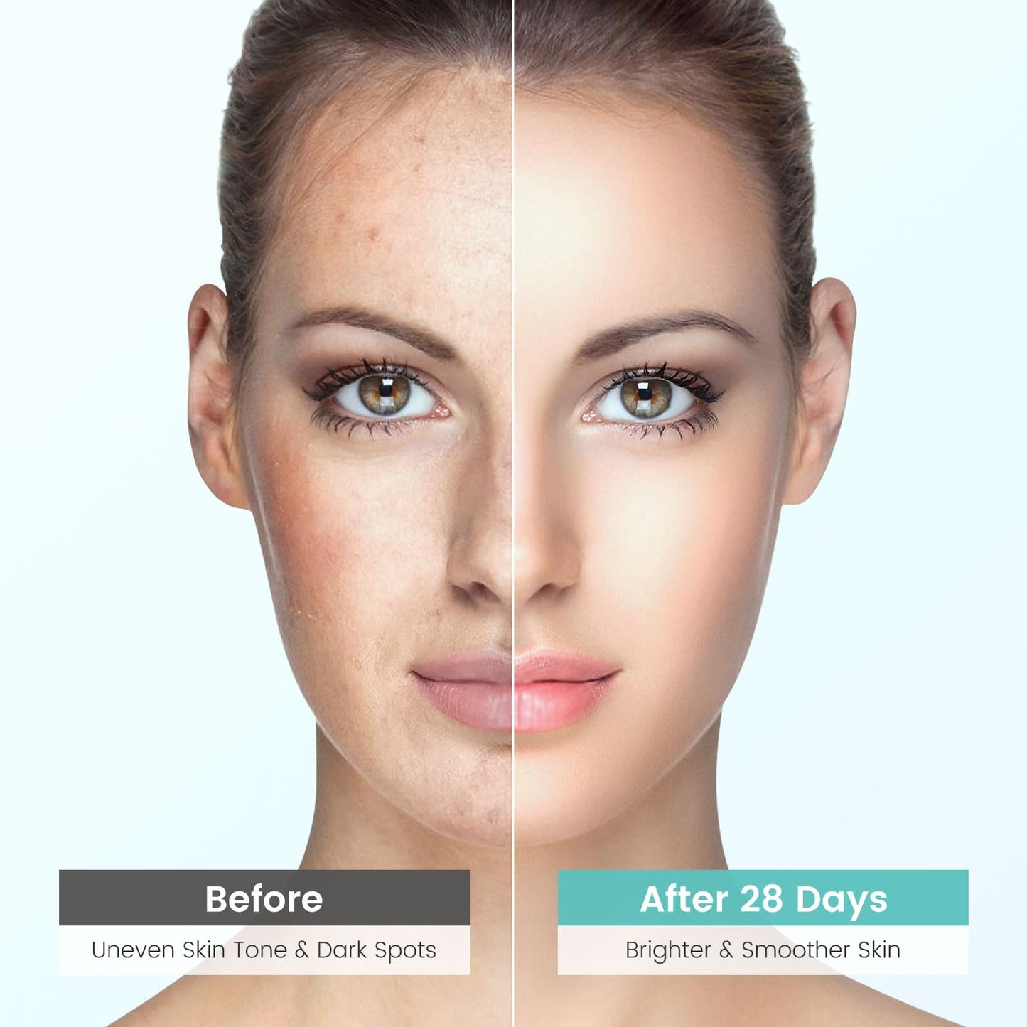 Jacrynth Dark Spot Remover Serum with 360° Roller — Acne Scars & Uneven Tone, 0.7 fl oz